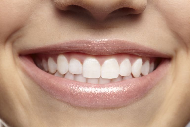bijela teeth