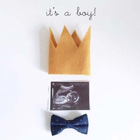 O's a Boy Scan Photo for Gender Reveal