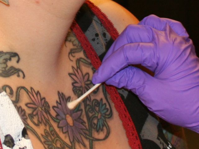 prepping the skin for dermal anchors