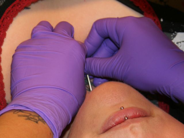 piercing the skin for dermal anchor