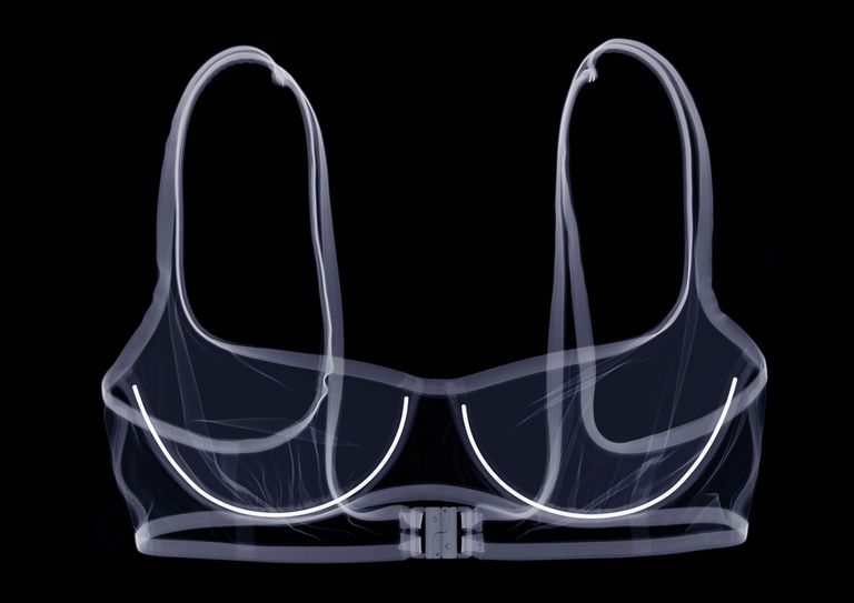 צילום רנטגן bra